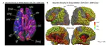 Neuroimaging Markers for Studying Gulf-War Illness: Single-Subject Level Analytical Method Based on Machine Learning